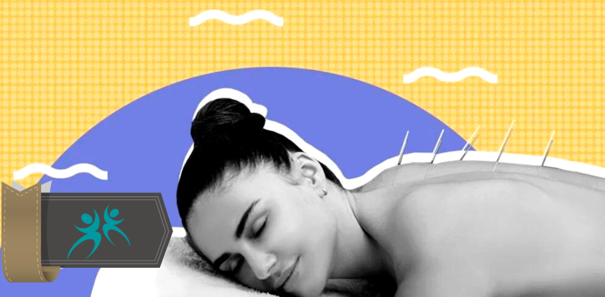 acupuncture for improving sleep
